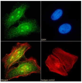 Anti-RAD23B [SAIC-28A-29]