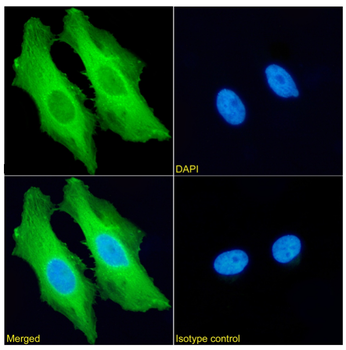 Anti-HSPB1 [SAIC-23C-35]