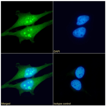Anti-HSPB1 [SAIC-23B-22]