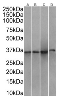 Anti-ANXA1 [SAIC-13B-19]