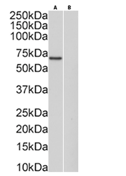 Anti-Protein C [HPC-4]