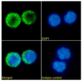 Anti-CD257 (BAFF) [Tabalumab]