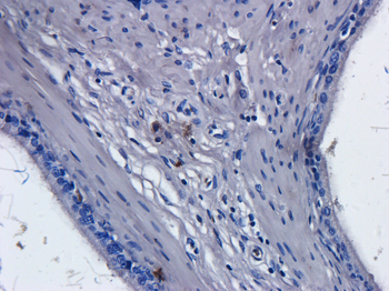 Anti-CD52 [Alemtuzumab (Campath-1H)]