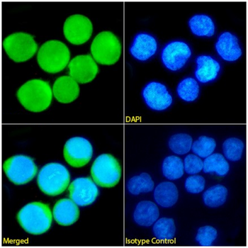 Anti-Terminal Deoxynucleotidyl Transferase [32D5]