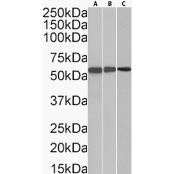 Anti-Terminal Deoxynucleotidyl Transferase [32D5]