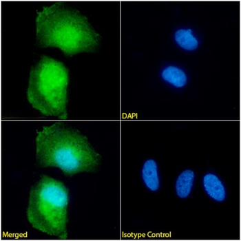 Anti-GFAP [10G1G11H7]