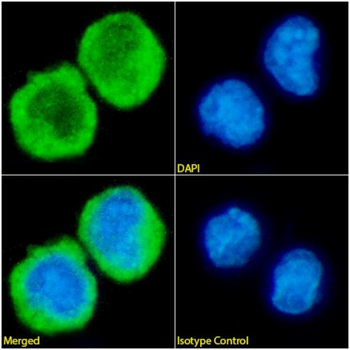 Anti-IL-2R Beta chain [Mik-beta 1]