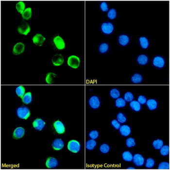 Anti-IL-12/23 [ABT-874 (Briakinumab)]