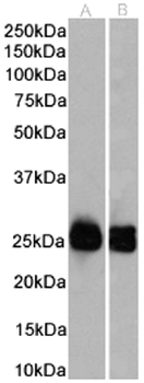 Anti-Mouse antibody kappa light chain [OX-20]
