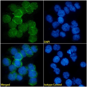 Anti-IL-4 [SB240683 (Pascolizumab, humanized 3B9)]