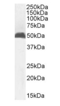 Anti-MHC I [R1-21.2]