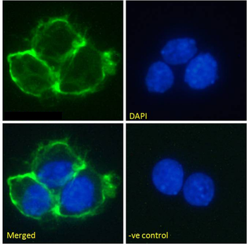 Anti-EGFR [Matuzumab]