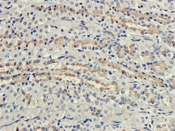 Anti-CD35 (complement receptor 1) [8C12]