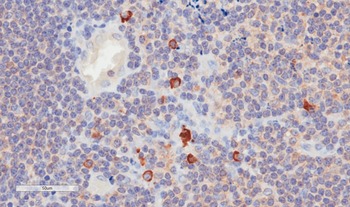 Anti-CD3 epsilon [YTH 12.5]