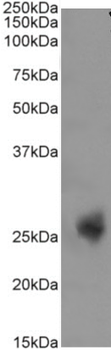 Anti-CD3 epsilon [YTH 12.5]
