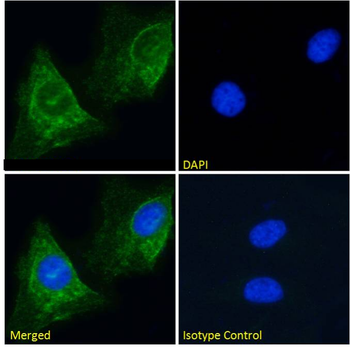 Anti-Human Muscle Acetylcholine Receptor [mAb 192]