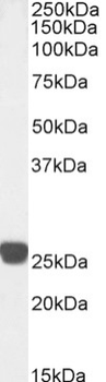 Rabbit Monoclonal Antibody to Cardiac Troponin I