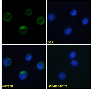Anti-Integrin beta-7 [FIB27]