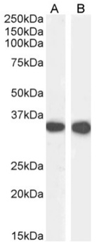 Anti-CD74 [In-1]