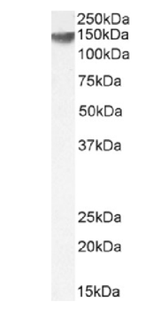 Anti-HER2/neu [SER4]