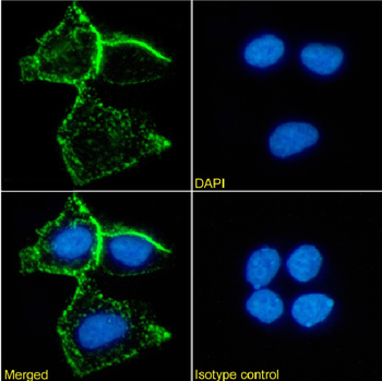 Anti-carcinoembryonic antigen [A5B7]