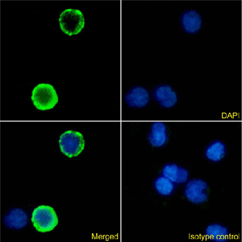 Anti-CD18 [1B4]