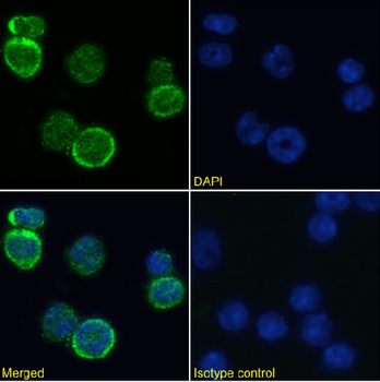 Anti-MHC I [R1-9.6]