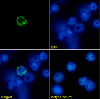 Anti-MHC I [R1-21.2]
