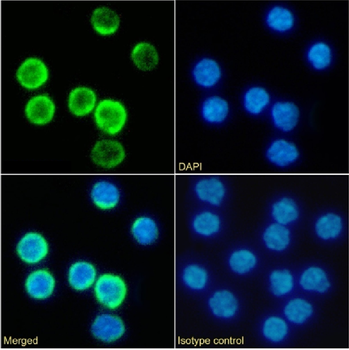 Anti-CD25 [PC-61.5.3]
