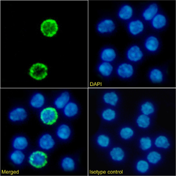 Anti-IL2R gamma C [3E12]
