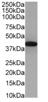 Anti-PD-1 [J43]
