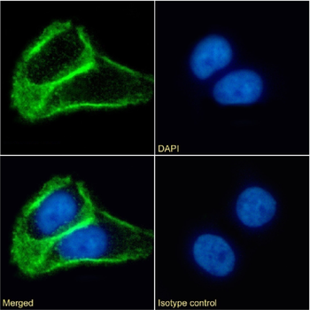 Anti-Tetraspanin 1 [4/12]
