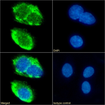 Anti-CD36 [185-1G2 (B467)]