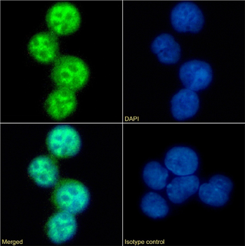 Anti-CCR5 (phosphoserine 337) [V14/2]