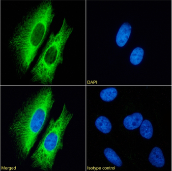 Anti-Cytokeratin 7 [OV-TL 12/30]