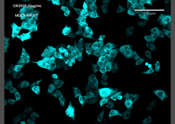 Anti-Covid-19 & SARS-CoV Nucleoprotein [CR3018 (03-018)]