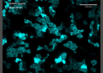 Anti-Covid-19 & SARS-CoV Nucleoprotein [CR3009 (03-009)]