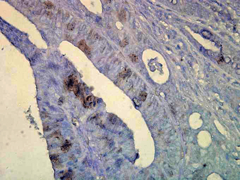 HSP70 Antibody (APC)