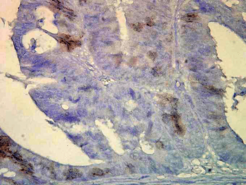 HSP70/HSC70 Antibody (Biotin)