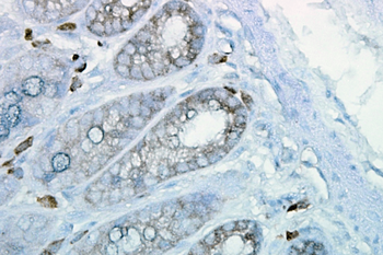 HSP90 Antibody (Biotin)