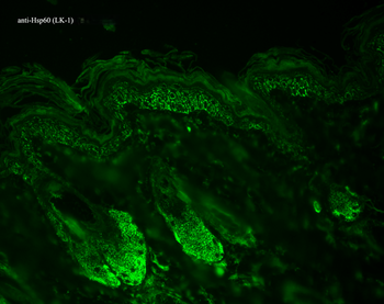 HSP60 Antibody (HRP)