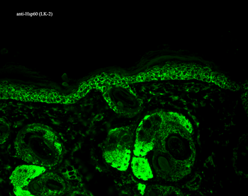 HSP60 Antibody (FITC)