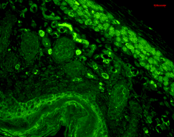 CD74 Antibody (FITC)