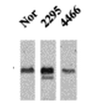 CaMKII Antibody (FITC)