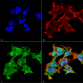 Alpha A Crystallin Antibody (FITC)