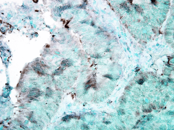 HSP90 Antibody (APC)