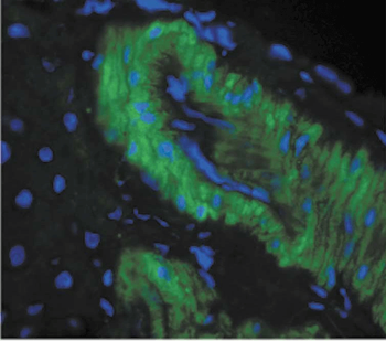 Nitrotyrosine Antibody (RPE)