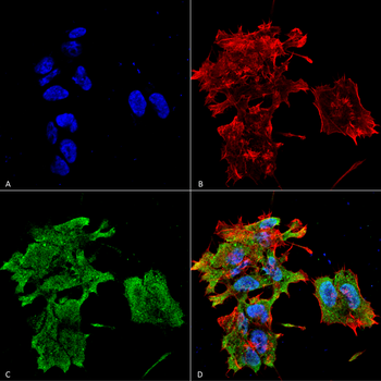 Alpha B Crystallin Antibody (FITC)