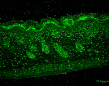 ERp57 Antibody (RPE)