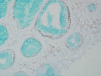 DNMT1 Antibody (FITC)